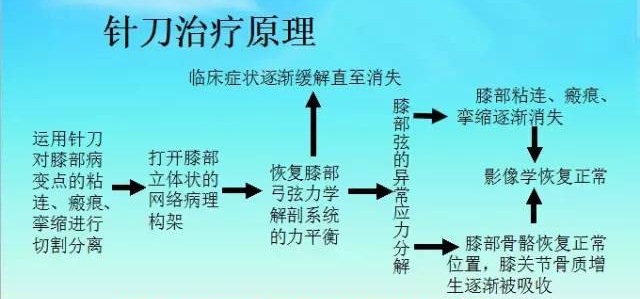 五指定位法针刀整体松解术治疗膝关节骨性关节炎
