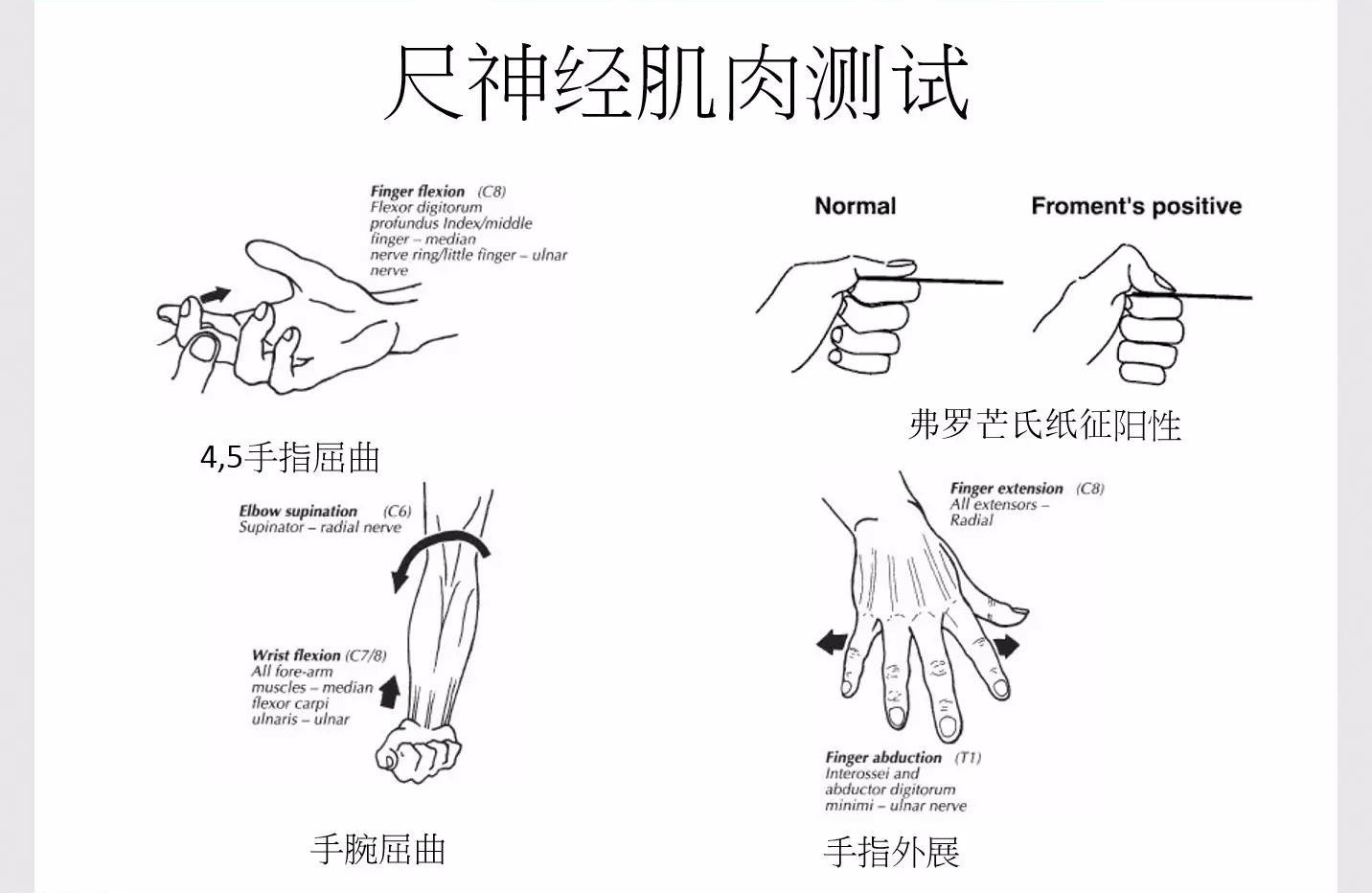 神经卡压感觉支持