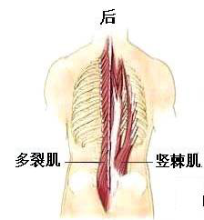 天民针刀横突棘肌