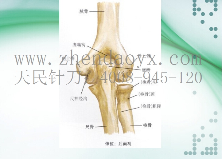 针刀治疗肘关节强直