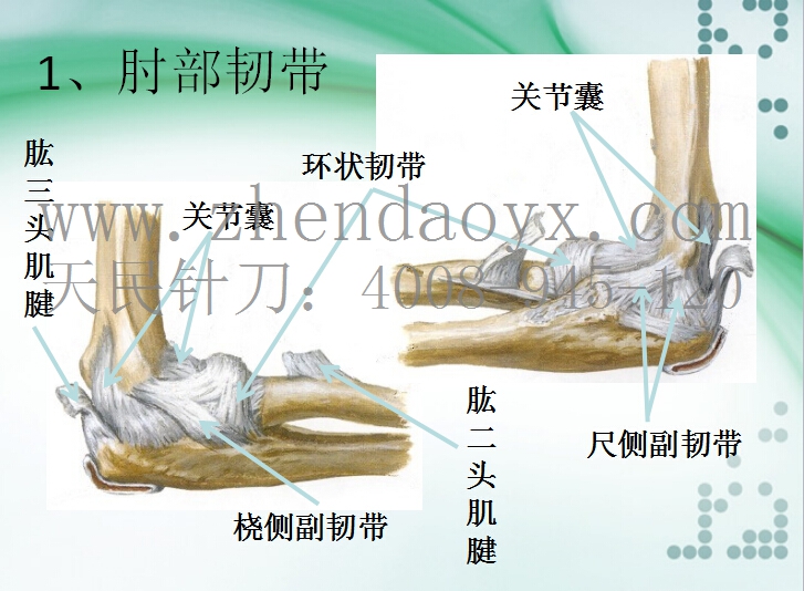 针刀治疗肘关节强直