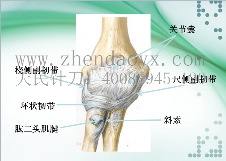 针刀治疗肘关节强直