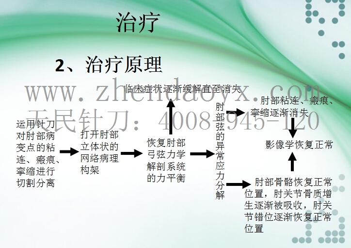 针刀治疗肘关节强直