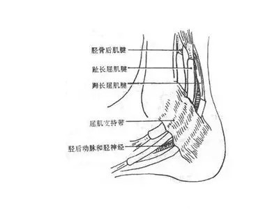 踝管综合征针刀治疗