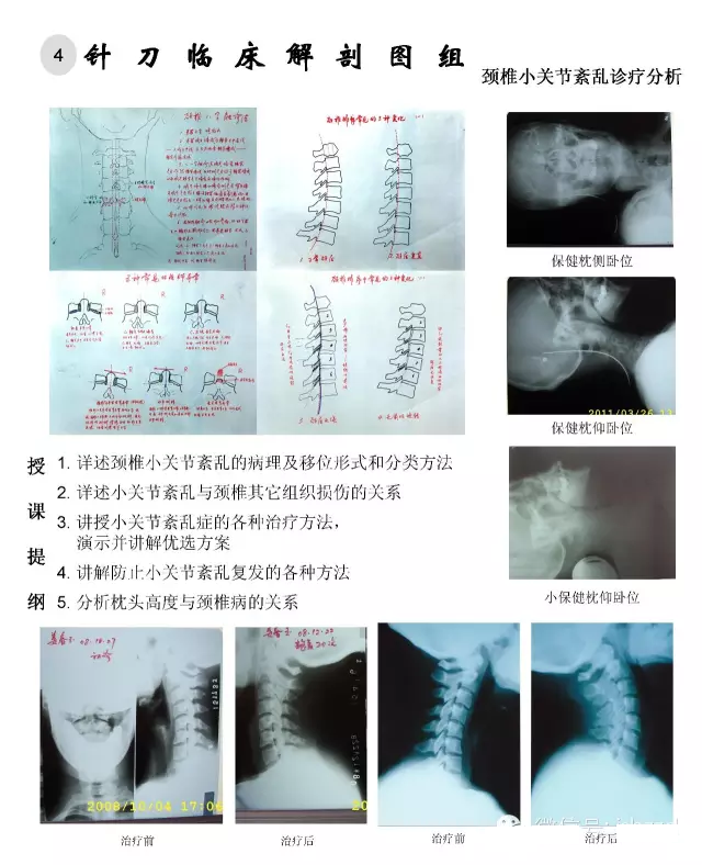临床解剖图谱