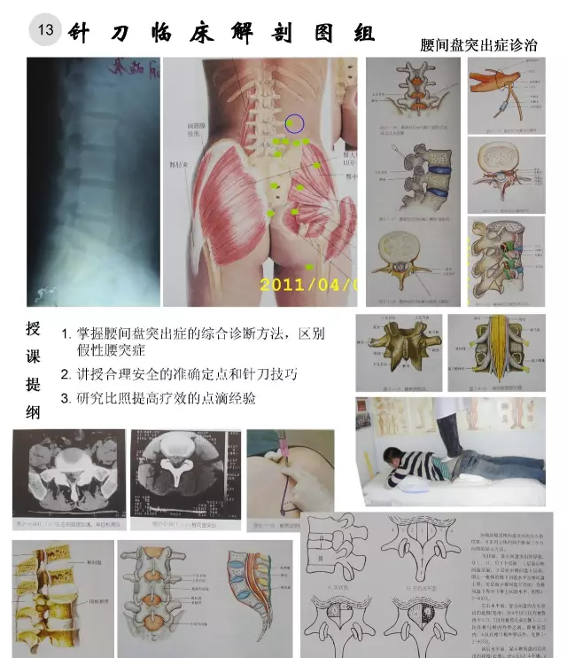 临床解剖图谱
