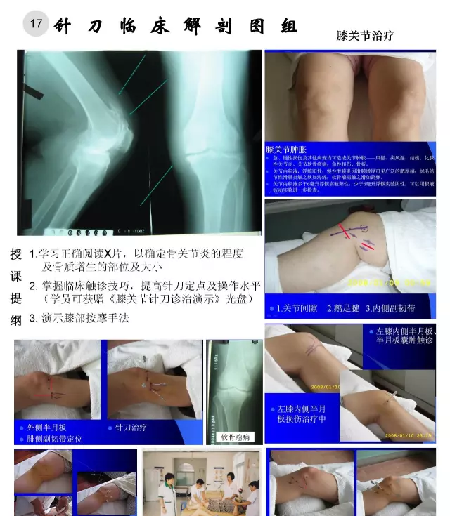 临床解剖图谱