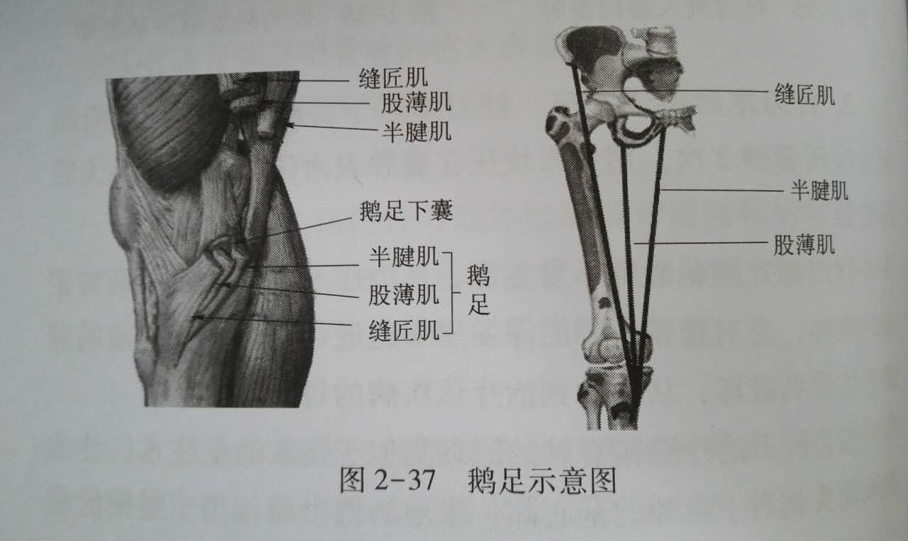 针刀治疗鹅足滑囊炎