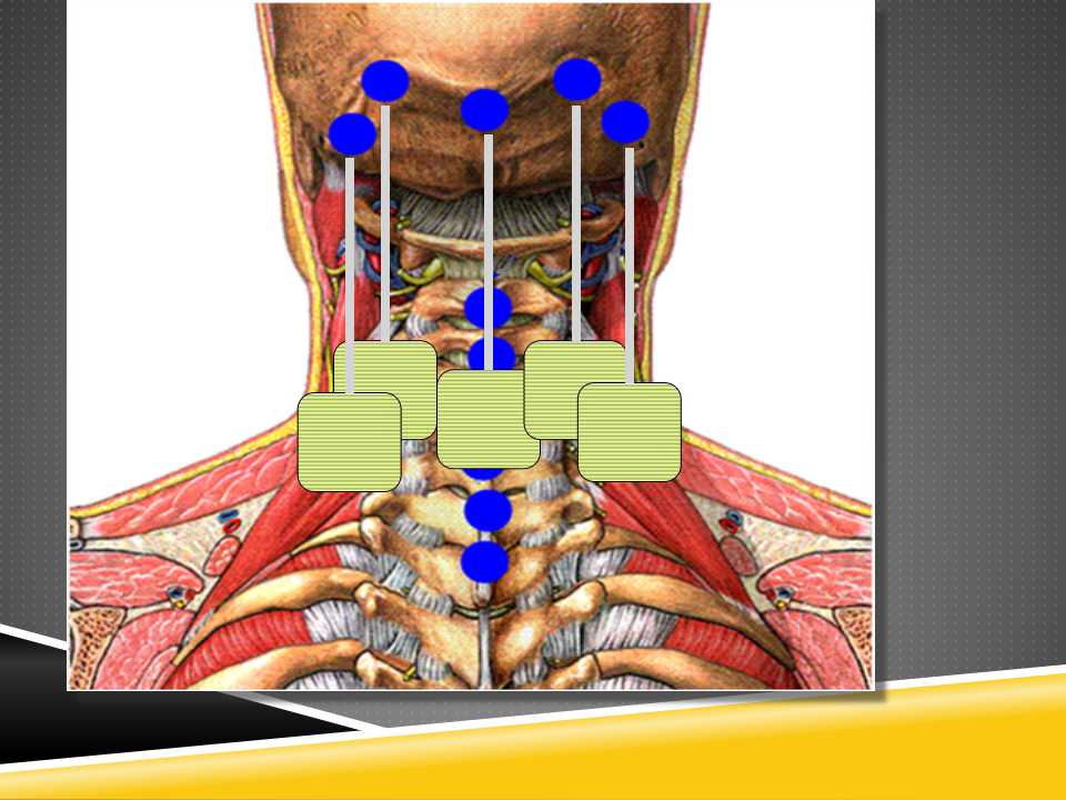 秦保和T型针刀整体松解术治疗颈性眩晕