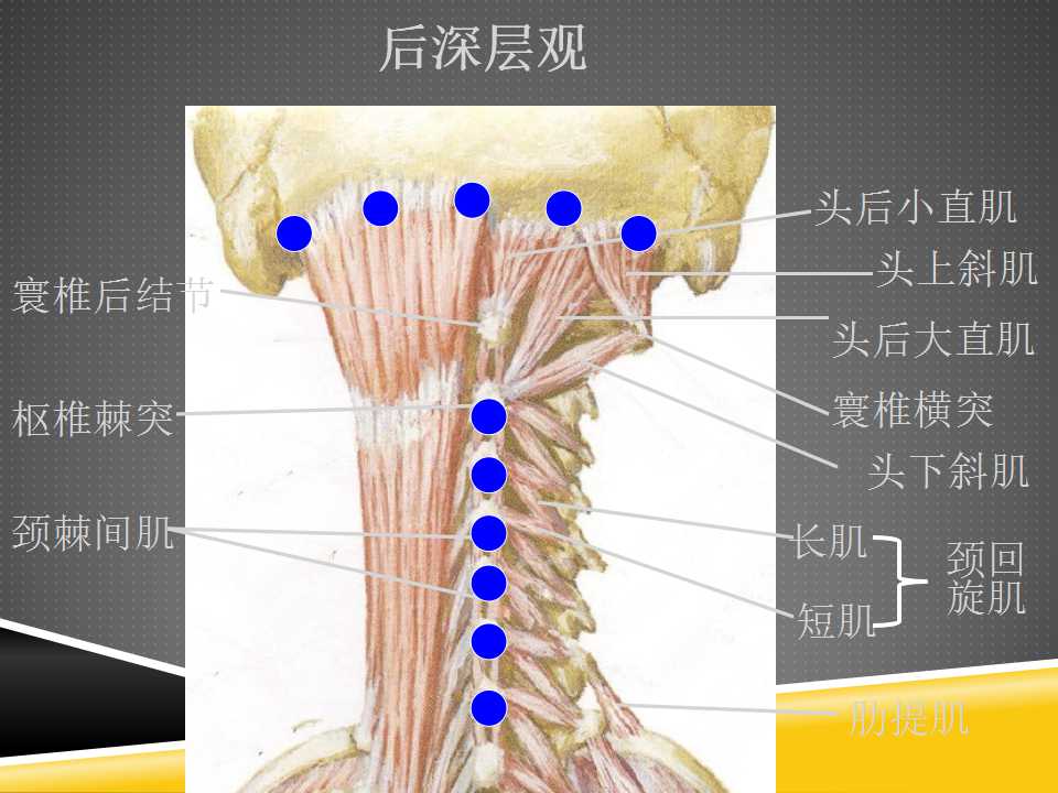 秦保和T型针刀整体松解术治疗颈性眩晕