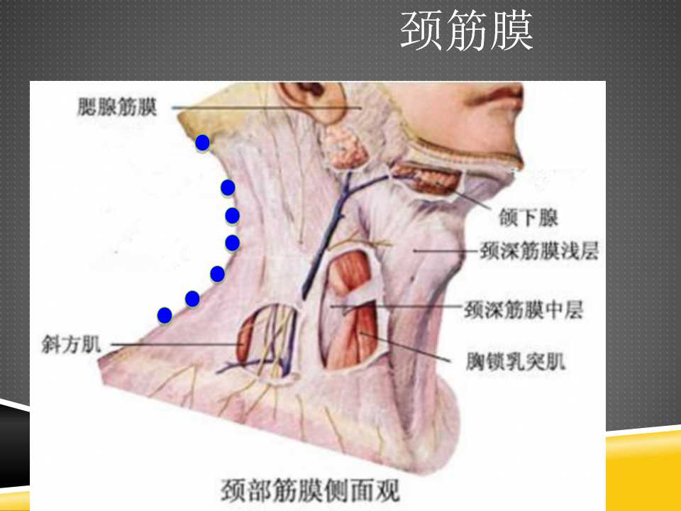 秦保和T型针刀整体松解术治疗颈性眩晕