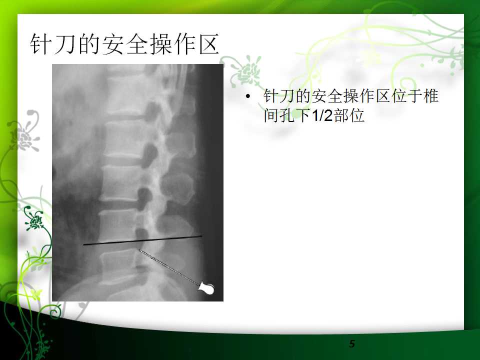 小针刀培训之腰椎横突的体表定位