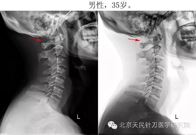 北京天民针刀医学研究院4008945120