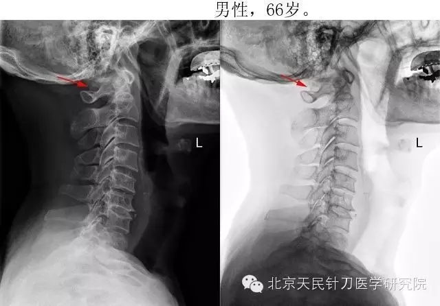 北京天民针刀医学研究院4008945120