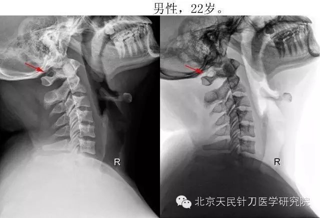 北京天民针刀医学研究院4008945120