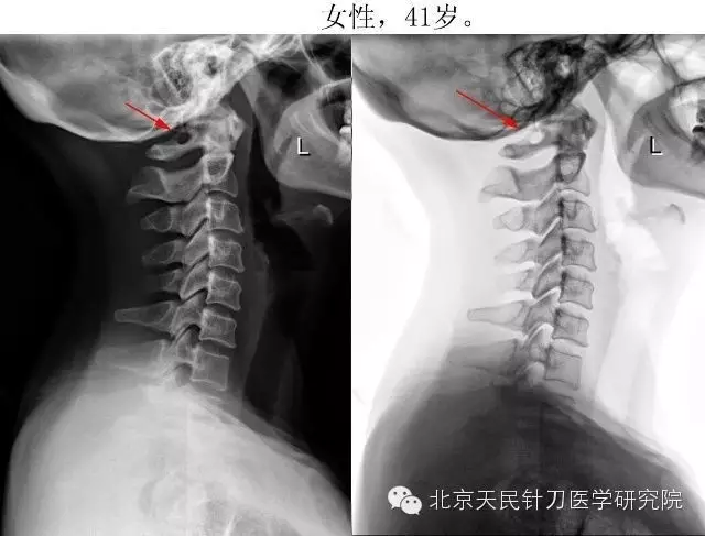 北京天民针刀医学研究院4008945120
