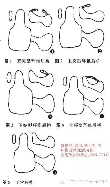 北京天民针刀医学研究院4008945120