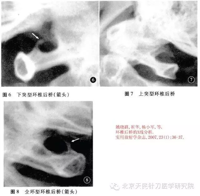 北京天民针刀医学研究院4008945120