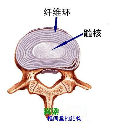 天民针刀培训-腰间盘突出