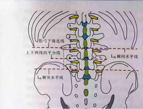 针刀治疗腰椎间盘突出症