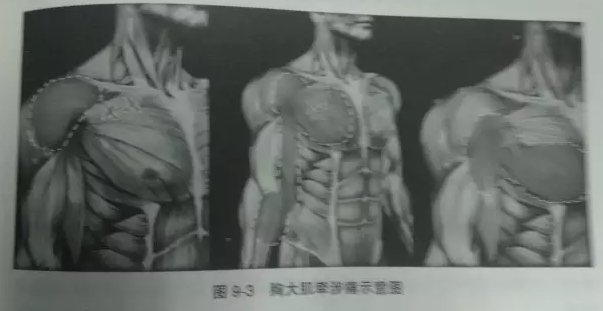 针刀治疗乳腺增生临床经验