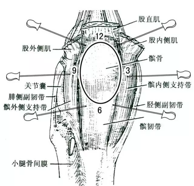 针刀治疗类风湿关节炎