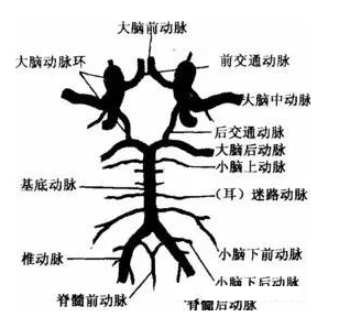 针刀治疗脑血管病后遗症