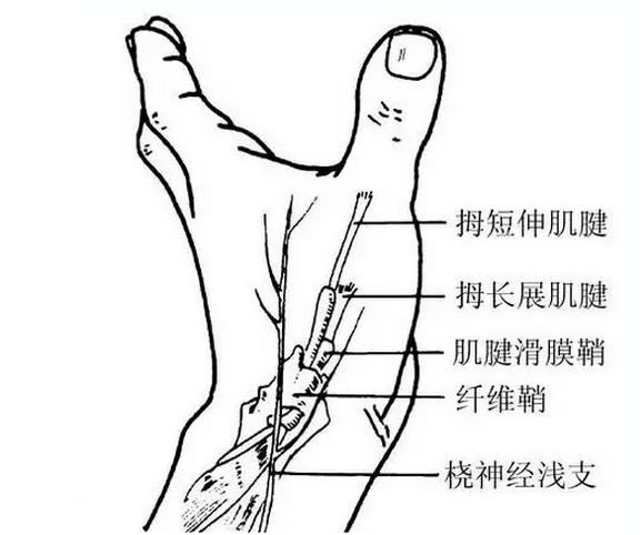 针刀松解屈指肌腱狭窄性腱鞘炎详解