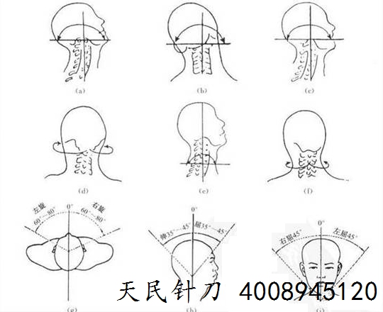 主动肌与拮抗肌