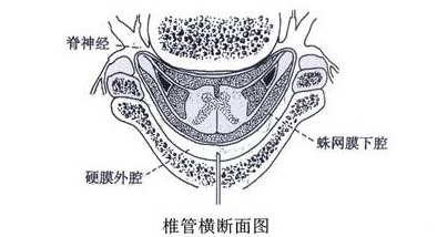 椎管内软组织损害性疼痛征象与检查 