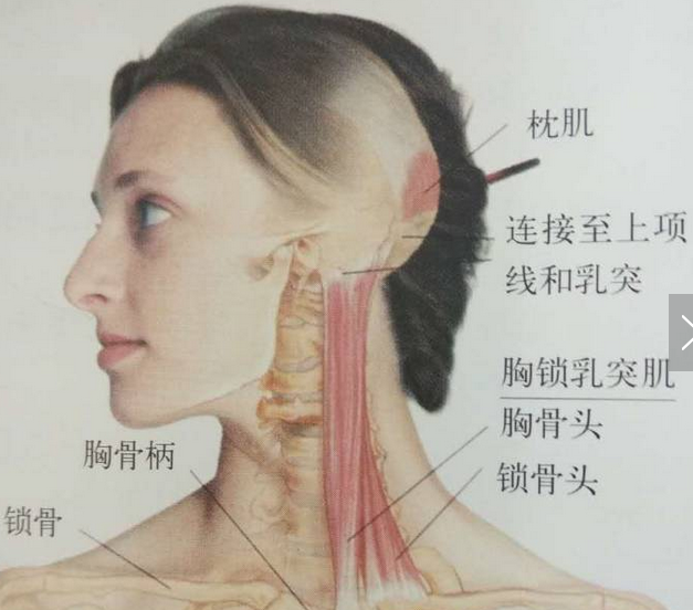 胸锁乳突肌